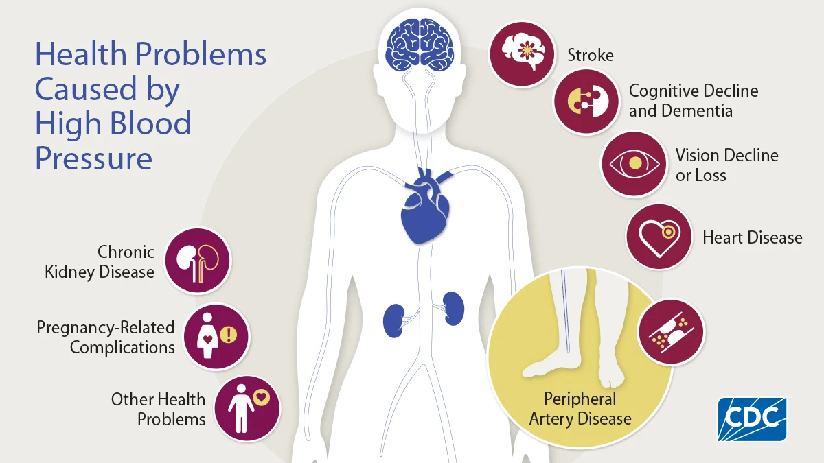 What Are The Long-Term Effects Of Untreated High Blood Pressure