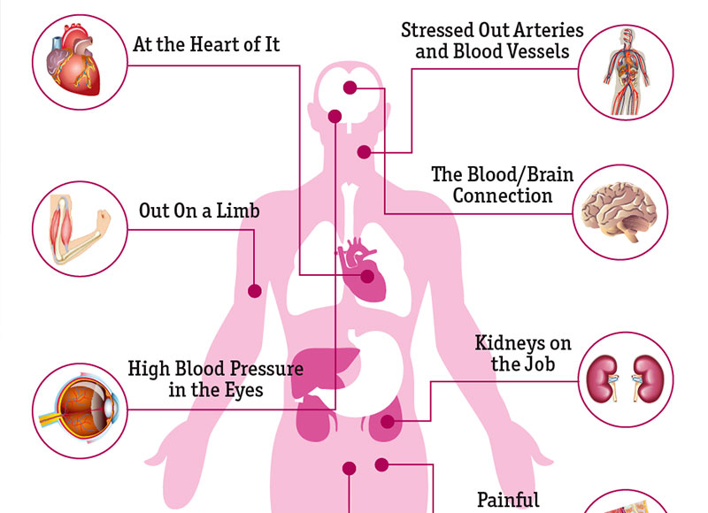 Negative Effects Of High Blood Pressure On Your Body | Dr. Sam Robbins